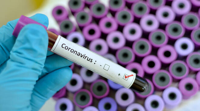 coronavirus-671491.660x368